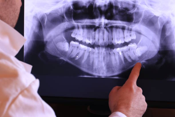 Best Emergency Dentist for Special Needs Patients in Flower Hill, NY
